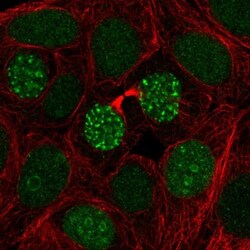 TIGD1 Antibody, Novus Biologicals:Antibodies:Primary Antibodies