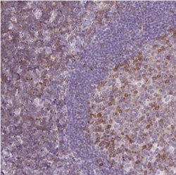 TIGD2 Antibody, Novus Biologicals:Antibodies:Primary Antibodies