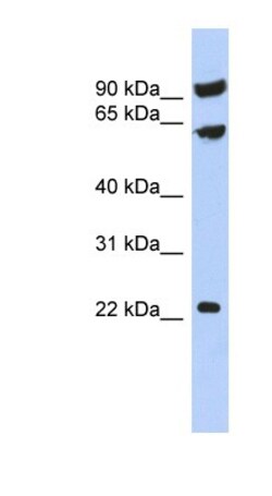TIGD3 Antibody, Novus Biologicals 100&mu;L; Unlabeled:Antibodies, Polyclonal