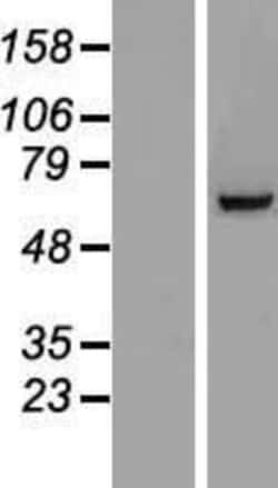 Novus Biologicals&trade;&nbsp;TIGD6 Overexpression Lysate