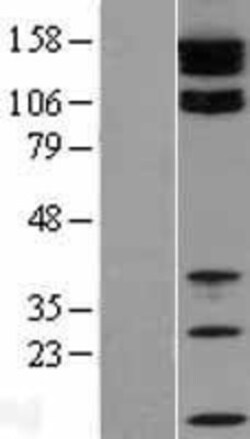 Novus Biologicals&trade;&nbsp;Tight Junction Protein 2 Overexpression Lysate