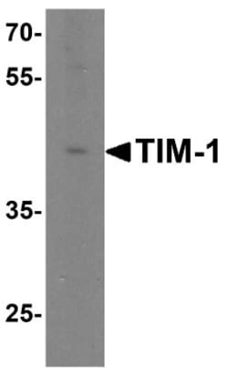 TIM-1/KIM-1/HAVCR Antibody - BSA Free, Novus Biologicals 0.025mg; Unlabeled:Antibodies,