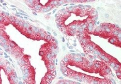 TIMBIM 1 Antibody, Novus Biologicals 0.1mg; Unlabeled:Antibodies, Polyclonal