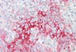 TIMBIM 1 Antibody, Novus Biologicals 0.1mg; Unlabeled:Antibodies, Polyclonal