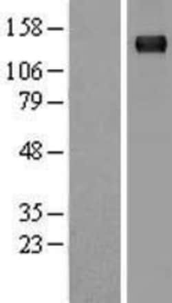 Novus Biologicals™ Timeless Overexpression Lysate