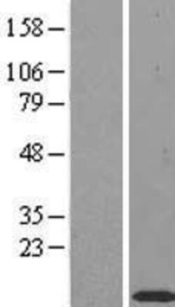 Novus Biologicals&trade;&nbsp;TIMM10 Overexpression Lysate