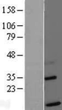 Novus Biologicals™ TIMM13 Overexpression Lysate
