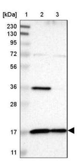 TIMM17A Antibody, Novus Biologicals 25 &mu;L; Unlabeled:Antibodies, Polyclonal