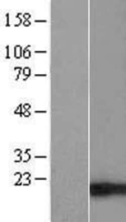 Novus Biologicals™ TIMM17B Overexpression Lysate