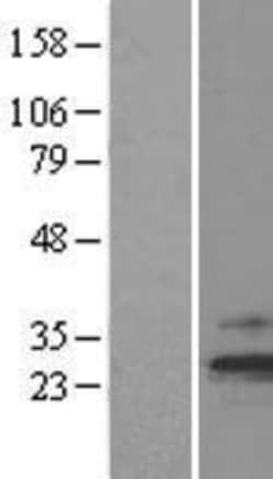 Novus Biologicals™ TIMM23 Overexpression Lysate