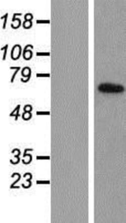 Novus Biologicals™ TIMM44 Overexpression Lysate
