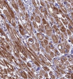 TIMM44 Antibody, Novus Biologicals 0.1mL; Unlabeled:Antibodies, Polyclonal