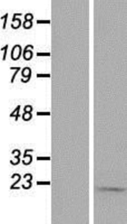 Novus Biologicals&trade;&nbsp;TIMM9 Overexpression Lysate