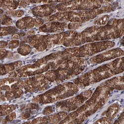 TIMM9 Antibody, Novus Biologicals 25 &mu;L; Unlabeled:Antibodies, Polyclonal