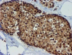 TIMP-2 Antibody (OTI1A6), Novus Biologicals 0.1mL; Unlabeled:Antibodies,