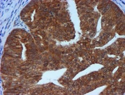 TIMP-2 Antibody (OTI1A6), Novus Biologicals 0.1mL; Unlabeled:Antibodies,