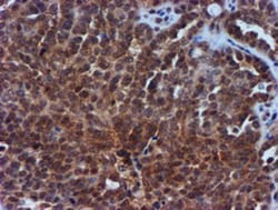 TIMP-2 Antibody (OTI1A6), Novus Biologicals 0.1mL; Unlabeled:Antibodies,