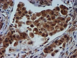 TIMP-2 Antibody (OTI1A6), Novus Biologicals 0.1mL; Unlabeled:Antibodies,