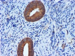 TIMP-2 Antibody (OTI1A6), Novus Biologicals 0.1mL; Unlabeled:Antibodies,