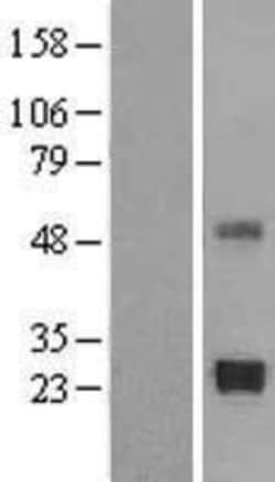 Novus Biologicals™ TIMP-2 Overexpression Lysate