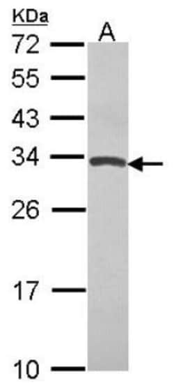 TIMP-4 Antibody, Novus Biologicals 0.1mL; Unlabeled:Antibodies, Polyclonal