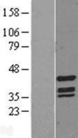 Novus Biologicals™ TIN2 Overexpression Lysate