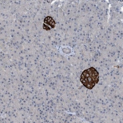 SP17 Antibody, Novus Biologicals:Antibodies:Primary Antibodies
