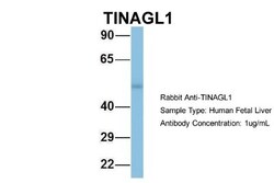 TINAGL1 Antibody, Novus Biologicals:Antibodies:Primary Antibodies