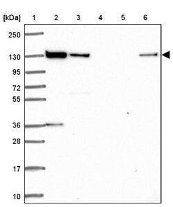 TIP120A Antibody, Novus Biologicals 25 &mu;L, Unlabeled:Antibodies, Polyclonal