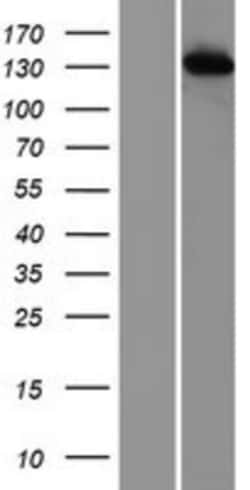 Novus Biologicals&trade;&nbsp;TIP120A Overexpression Lysate