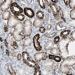 TIP120B Antibody, Novus Biologicals:Antibodies:Primary Antibodies