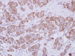 TIP30 Antibody, Novus Biologicals 0.1mL; Unlabeled:Antibodies, Polyclonal