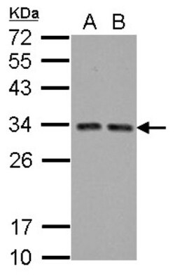 TIP30 Antibody, Novus Biologicals 0.1mL; Unlabeled:Antibodies, Polyclonal