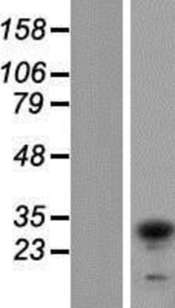 Novus Biologicals&trade;&nbsp;TIP30 Overexpression Lysate