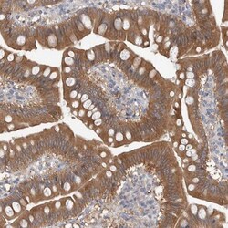 TIP30 Antibody, Novus Biologicals:Antibodies:Primary Antibodies