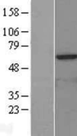 Novus Biologicals&trade;&nbsp;TIP60 Overexpression Lysate