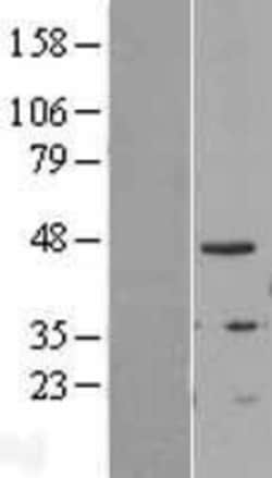 Novus Biologicals&trade;&nbsp;TIPIN Overexpression Lysate