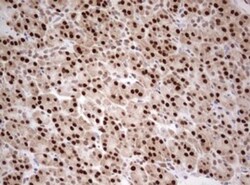 TIPIN Antibody (OTI2E6), Novus Biologicals 0.1mL; Unlabeled:Antibodies,