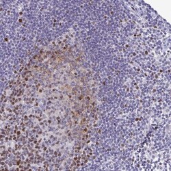 TIPIN Antibody, Novus Biologicals 25 &mu;L, Unlabeled:Antibodies, Polyclonal