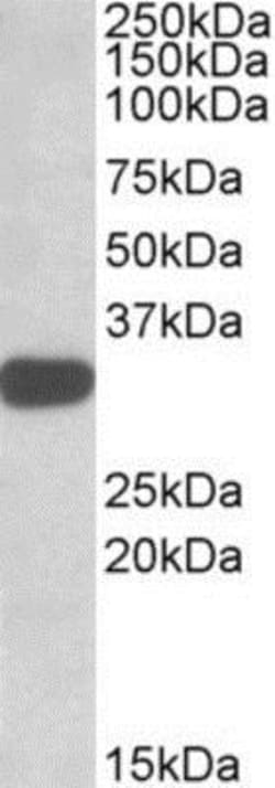 TIPRL Antibody, Novus Biologicals 0.1mg; Unlabeled:Antibodies, Polyclonal