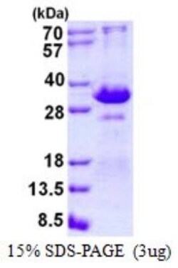 Novus Biologicals&trade;&nbsp;Recombinant Human TIRAP (TLR2 and TLR4) His Protein