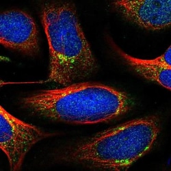 TISP43 Antibody, Novus Biologicals:Antibodies:Primary Antibodies