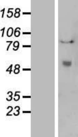 Novus Biologicals™ t-Plasminogen Activator/tPA Overexpression Lysate