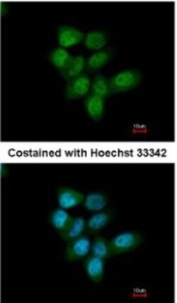 TKTL1 Antibody, Novus Biologicals 0.1mL; Unlabeled:Antibodies, Polyclonal