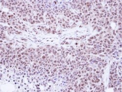 TKTL1 Antibody, Novus Biologicals 0.1mL; Unlabeled:Antibodies, Polyclonal