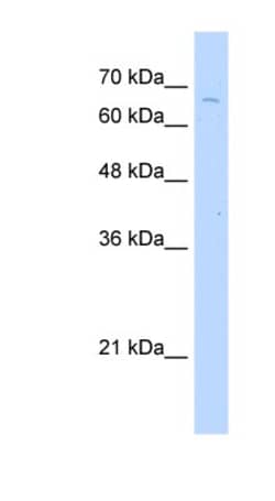 TKTL2 Antibody, Novus Biologicals:Antibodies:Primary Antibodies