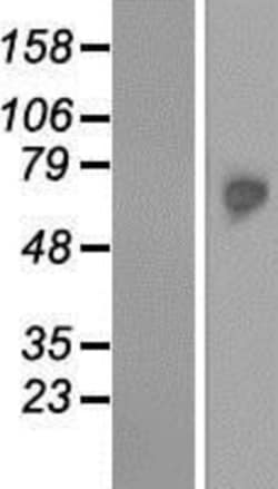 Novus Biologicals&trade;&nbsp;TKTL2 Overexpression Lysate