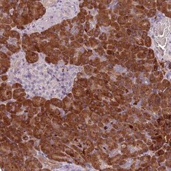 TLCD2 Antibody, Novus Biologicals:Antibodies:Primary Antibodies