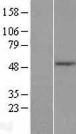 Novus Biologicals&trade;&nbsp;TLE6 Overexpression Lysate