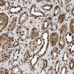 TLK1 Antibody, Novus Biologicals 25 &mu;L; Unlabeled:Antibodies, Polyclonal